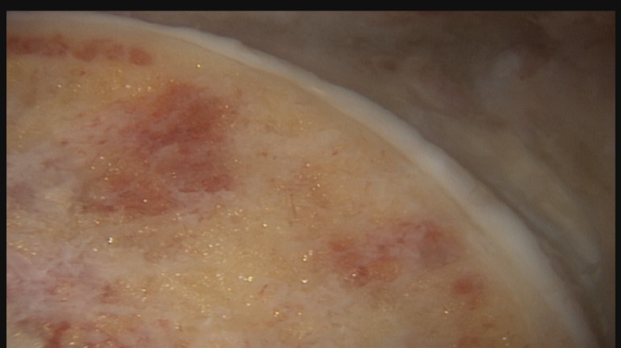 Von links unten nach rechts oben gelb mit roten Pflecken und einen weißen Rand das ganze abgerundet mit transparenten Blasen.